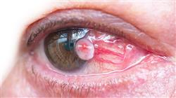 especialización patologias oculares diagnostico terapeutica