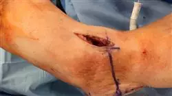 ##IMAGE##