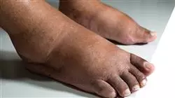##IMAGE##