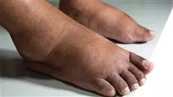 ##IMAGE##