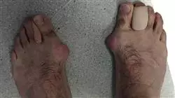 ##IMAGE##