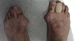 ##IMAGE##