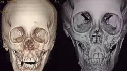 ##IMAGE##