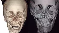 ##IMAGE##