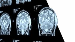 especializacion oncologia cabeza cuello
