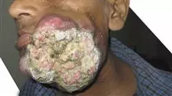 ##IMAGE##