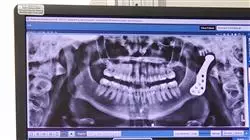 estudiar patologia dentoesqueletica articulacion temporomandibular