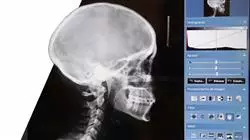 experto online patologia dentoesqueletica articulacion temporomandibular