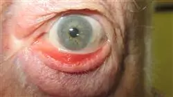 ##IMAGE##