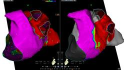diplomado nuevas tecnologias tecnicas imagen cardiologia