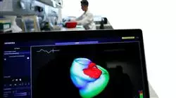 ##IMAGE##