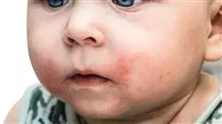 ##IMAGE##