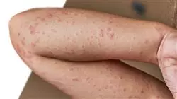 ##IMAGE##