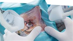 diplomado patologia tumoral vascular orbitaria abordaje quirurgico orbita