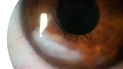 ##IMAGE##
