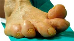 curso online cirugia antepie patologias primer radio