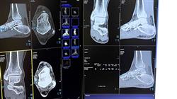 diplomado cirugia antepie patologias primer radio