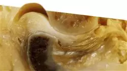 ##IMAGE##