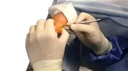 ##IMAGE##