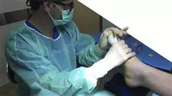 diplomado online cirugia antepie patologias dedos trifalangicos metatarsos