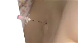 ##IMAGE##