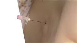 ##IMAGE##
