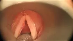 ##IMAGE##