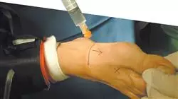 ##IMAGE##