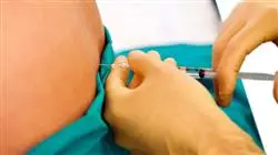##IMAGE##