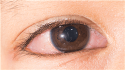 diplmado urgencias pediatricas dermatologia oftalmologia otorrinolaringologia