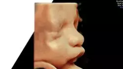 ##IMAGE##