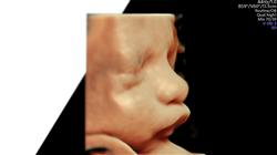 maestria online medicina fetal diagnostico prenatal
