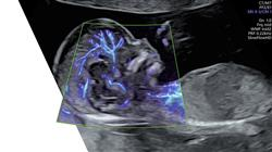 magister medicina fetal diagnostico prenatal