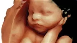 ##IMAGE##
