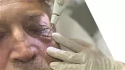 ##IMAGE##