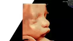 ##IMAGE##