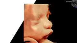 ##IMAGE##