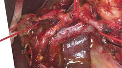 maestria cirugia oncologica digestiva