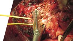master online cirugia oncologica digestiva