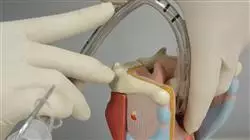 ##IMAGE##