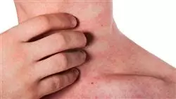 ##IMAGE##