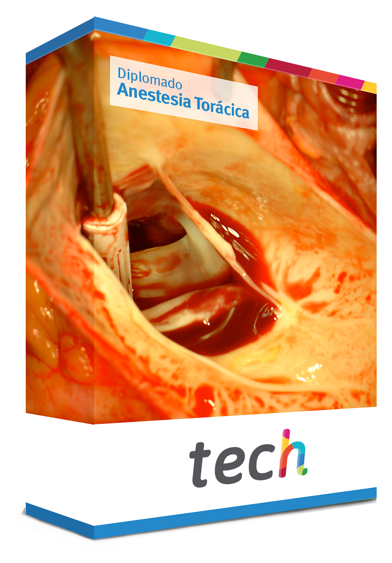 diplomado anestesia toracica caja