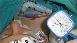 curso online anestesia cardiovascular