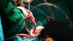 diplomado anestesia cardiovascular