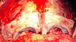 curso neuroanestesia