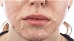 ##IMAGE##