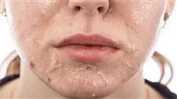 ##IMAGE##