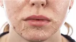 ##IMAGE##