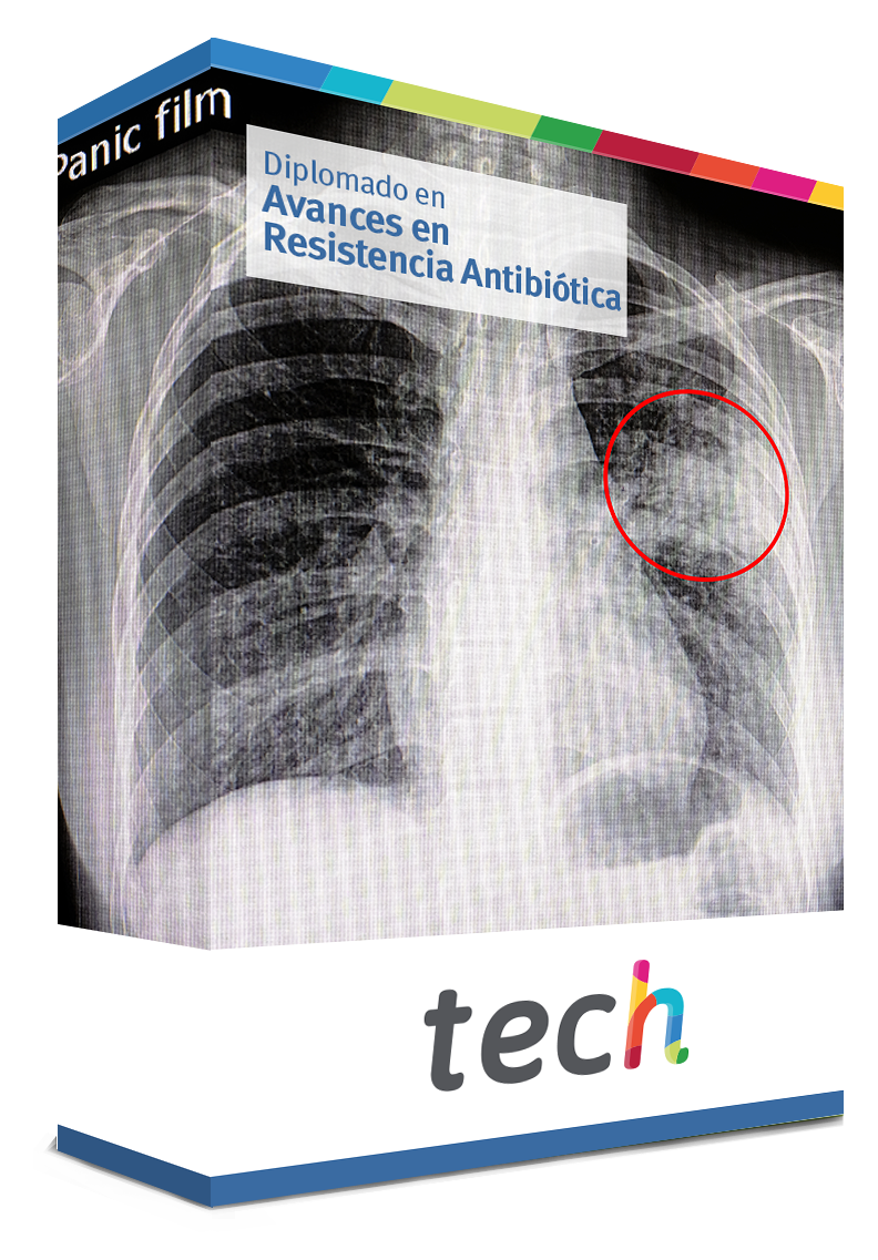 diplomado avances resistencia antibiotica caja