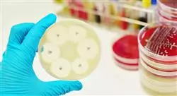 curso online microbiología en antibioticoterapia